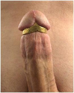 penis crown.JPG